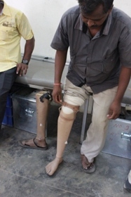 StandingtallwithhisJaipurfoot