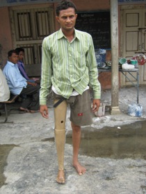 StandingtallwithhisJaipurfoot