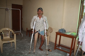 StandingtallwithhisJaipurfoot