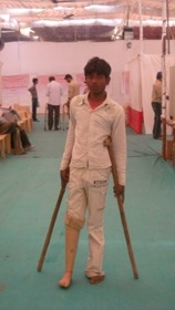StandingtallwithhisJaipurfoot
