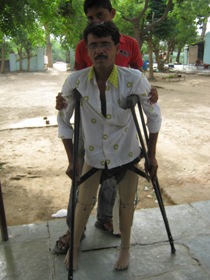 StandingtallwithhisJaipurfoot