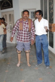 StandingtallwithhisJaipurfoot