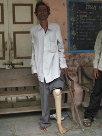 StandingtallwithhisJaipurfoot