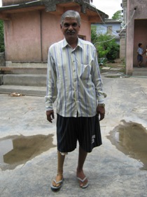 StandingtallwithhisJaipurfoot
