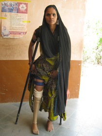 StandingtallwitheherJaipurfoot