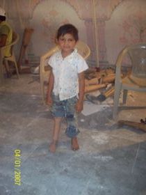 StandingtallwithhisJaipurfoot