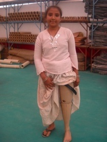 StandingtallwithherJaipurfoot
