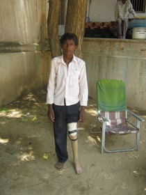 StandingtallwithhisJaipurfoot