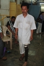 StandingtallwithhisJaipurfoot