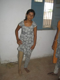 StandingtallwitheherJaipurfoot