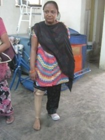 StandingtallwithherJaipurfoot
