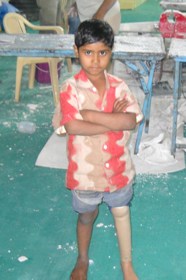 ChildwithJaipurFoot