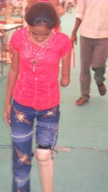 StandingtallwithherJaipurfoot