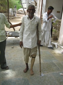 StandingtallwithhisJaipurfoot
