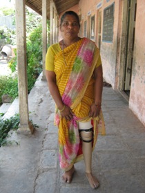 StandingtallwithherJaipurfoot