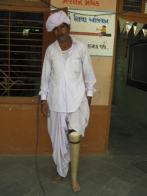 StandingtallwithhisJaipurfoot