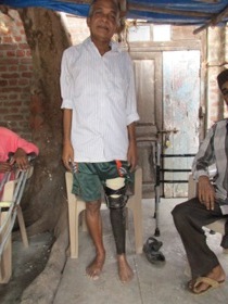StandingtallwithhisJaipurfoot