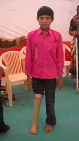 ChildwithJaipurFoot