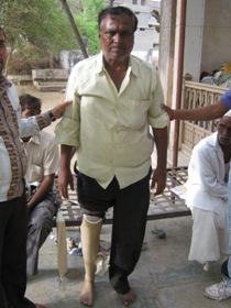 StandingtallwithhisJaipurfoot