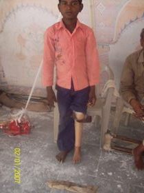 StandingtallwithhisJaipurfoot