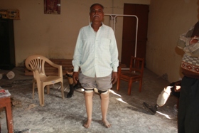 StandingtallwithhisJaipurfoot