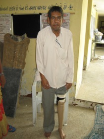 StandingtallwithhisJaipurfoot