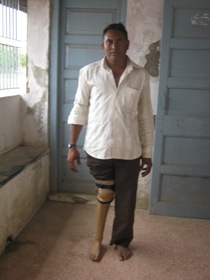 StandingtallwithhisJaipurfoot