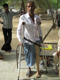 StandingtallwithhisJaipurfoot