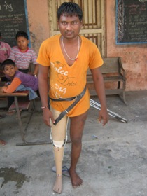 StandingtallwithhisJaipurfoot