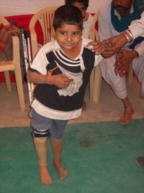 StandingtallwithhisJaipurfoot