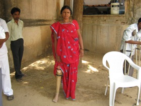 StandingtallwithhisJaipurfoot