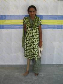 StandingtallwithherJaipurfoot