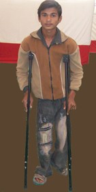 Disabledpersonwithcrutches