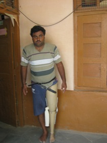 StandingtallwithhisJaipurfoot