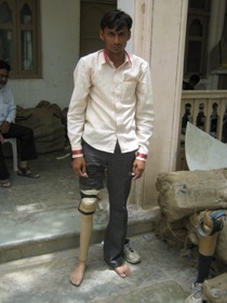 StandingtallwithhisJaipurfoot