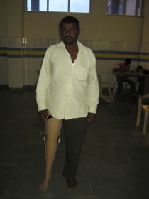 StandingtallwithhisJaipurfoot