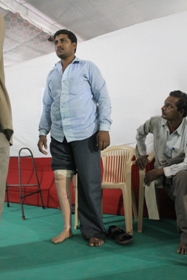 StandingtallwithhisJaipurfoot