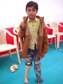 StandingtallwithherJaipurfoot