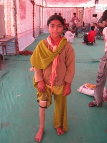 StandingtallwithherJaipurfoot