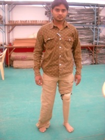 StandingtallwithhisJaipurfoot