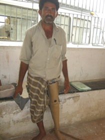 StandingtallwithhisJaipurfoot