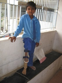 StandingtallwithhisJaipurfoot