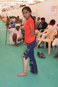 StandingtallwithherJaipurfoot