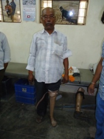 StandingtallwithhisJaipurfoot