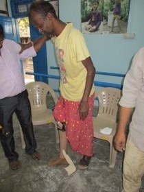 StandingtallwithhisJaipurfoot
