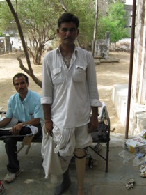 StandingtallwithhisJaipurfoot