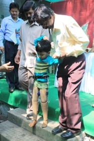ChildwithJaipurFoot