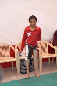 StandingtallwithhisJaipurfoot