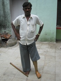 StandingtallwithhisJaipurfoot