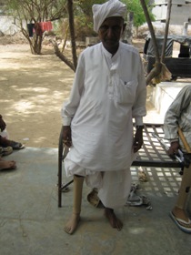 StandingtallwithhisJaipurfoot